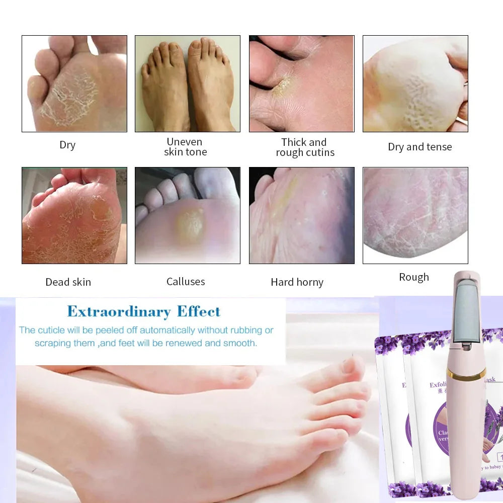 Râpe Pied Electrique pour rendre vos pieds lisse et doux