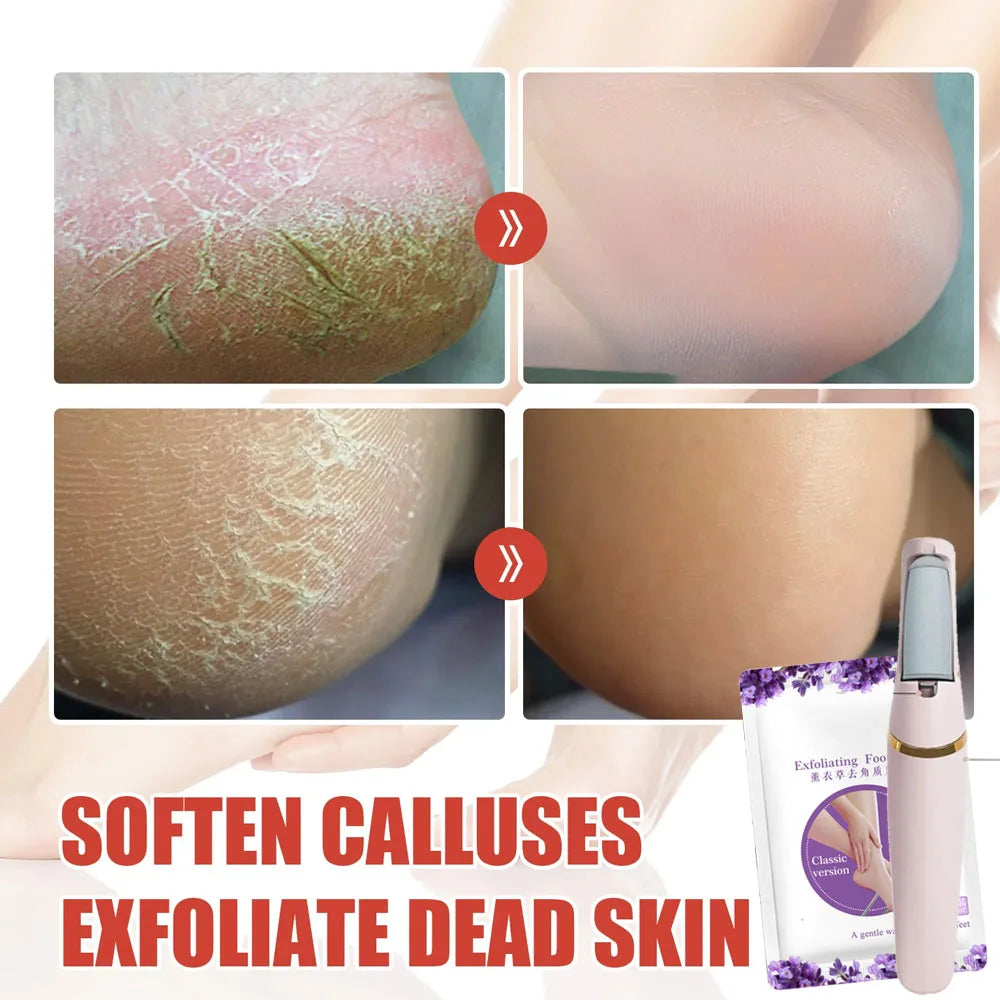 Râpe Pied Electrique pour rendre vos pieds lisse et doux